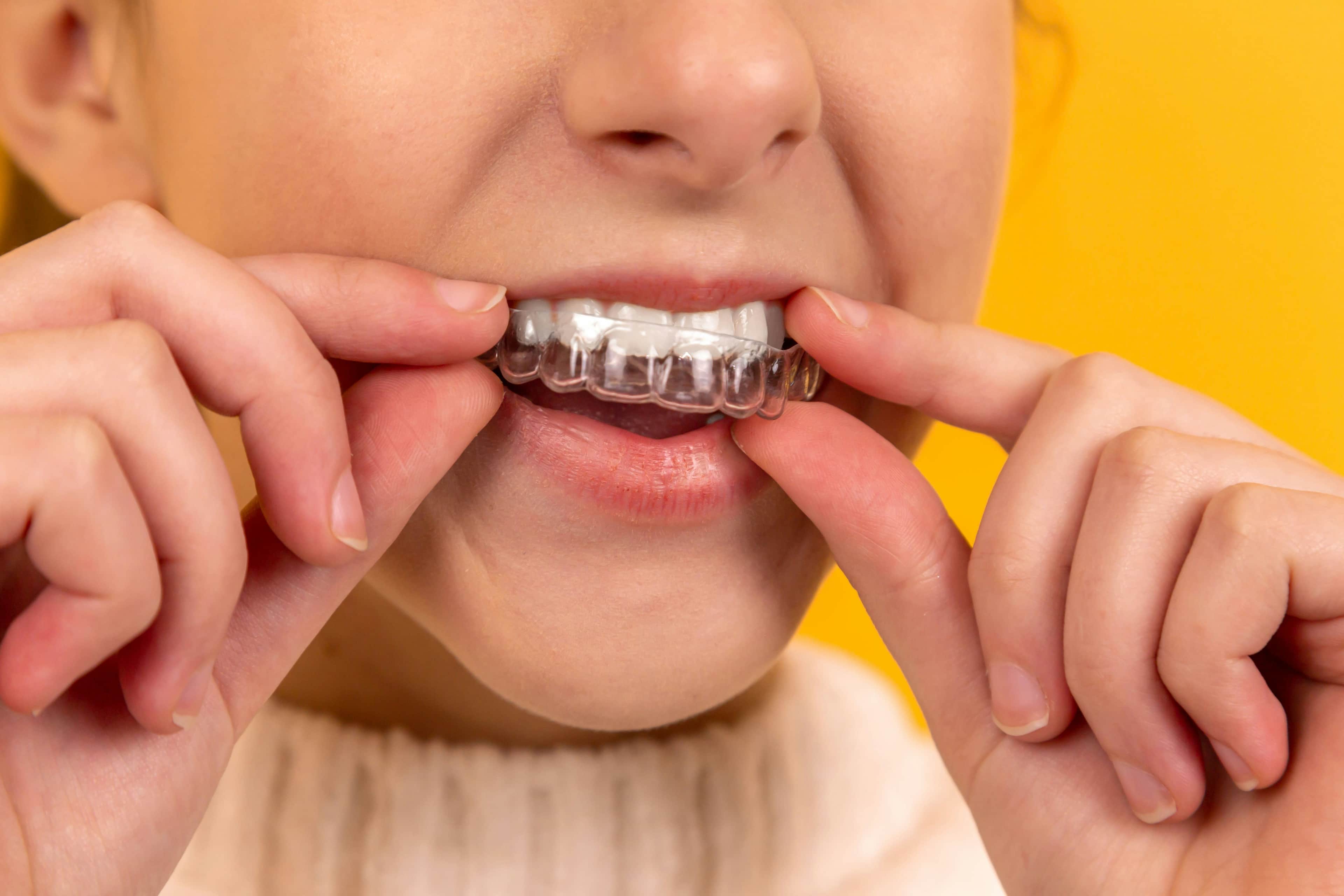 Dental technology