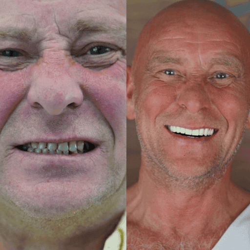 Фото пациента 2