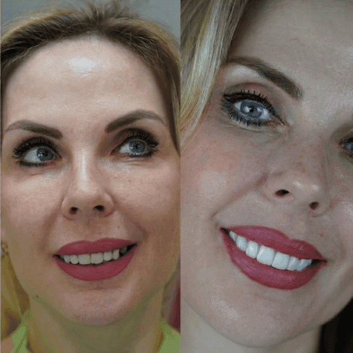 Фото пациента 4