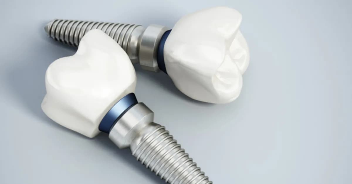 MegaGen diş implantı sistemi görseli