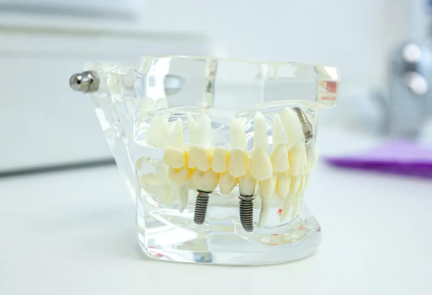 Straumann ve MegaGen diş implantı karşılaştırma görseli
