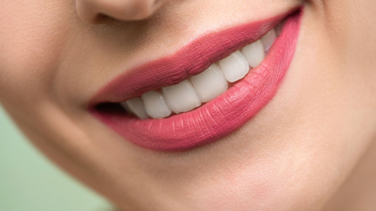 Hollywood Smile fiyat faktörlerini gösteren danışmanlık görseli