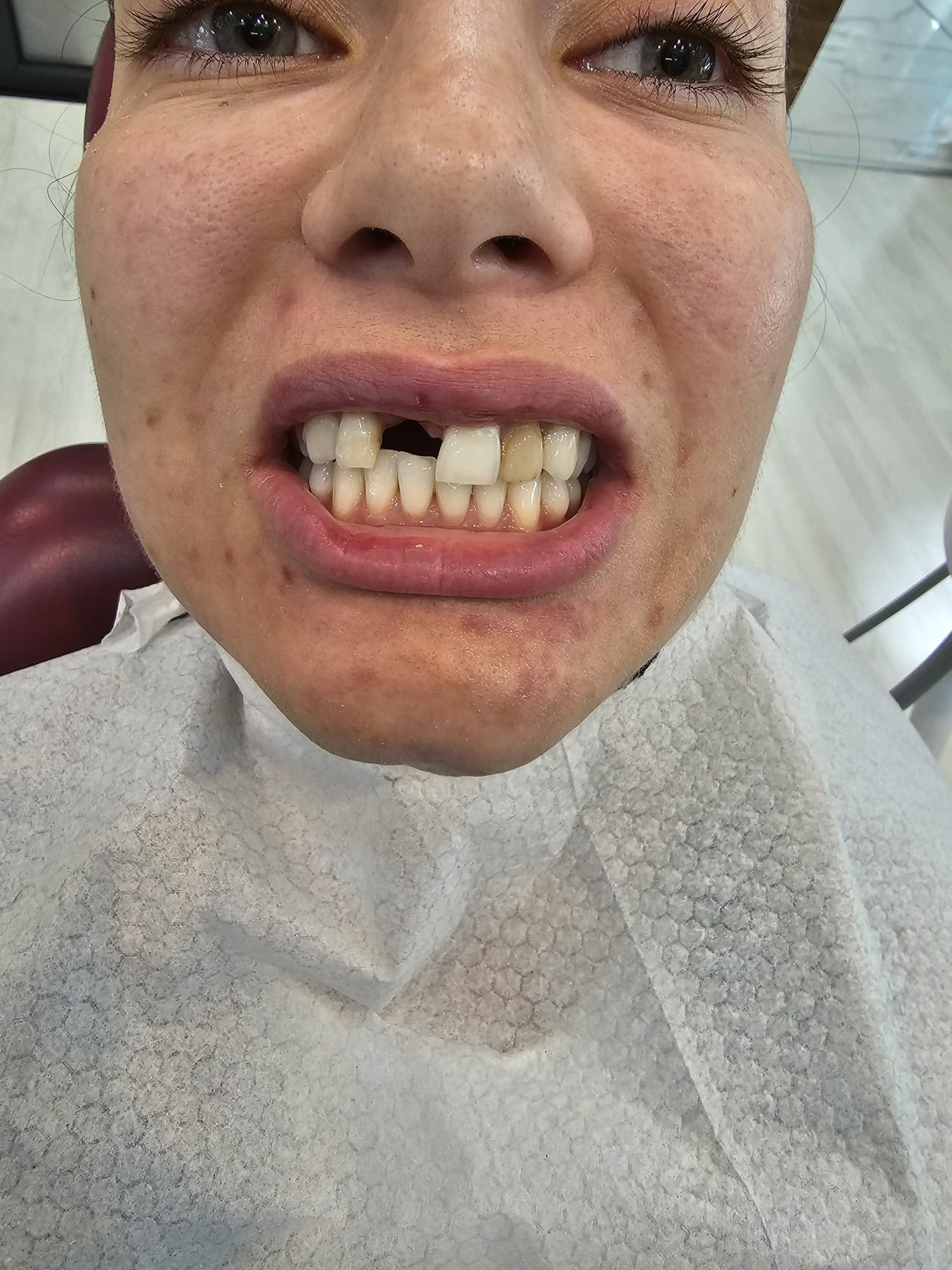 Before