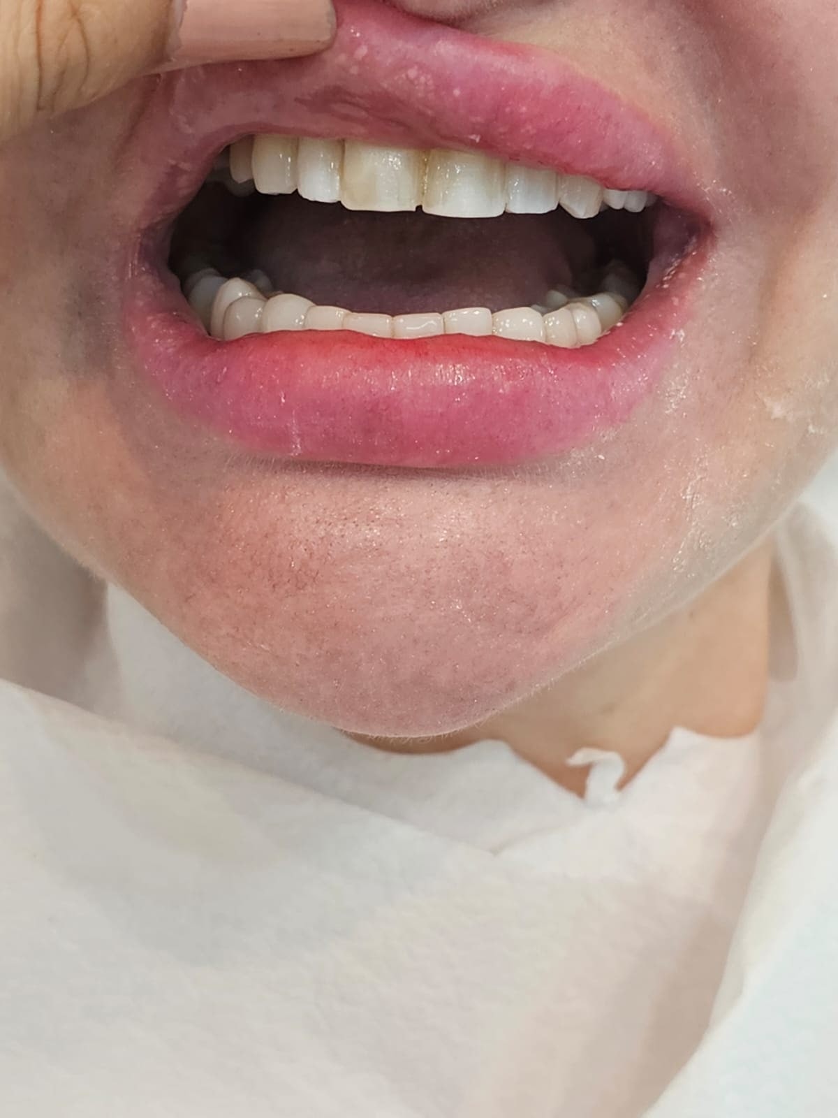 Before