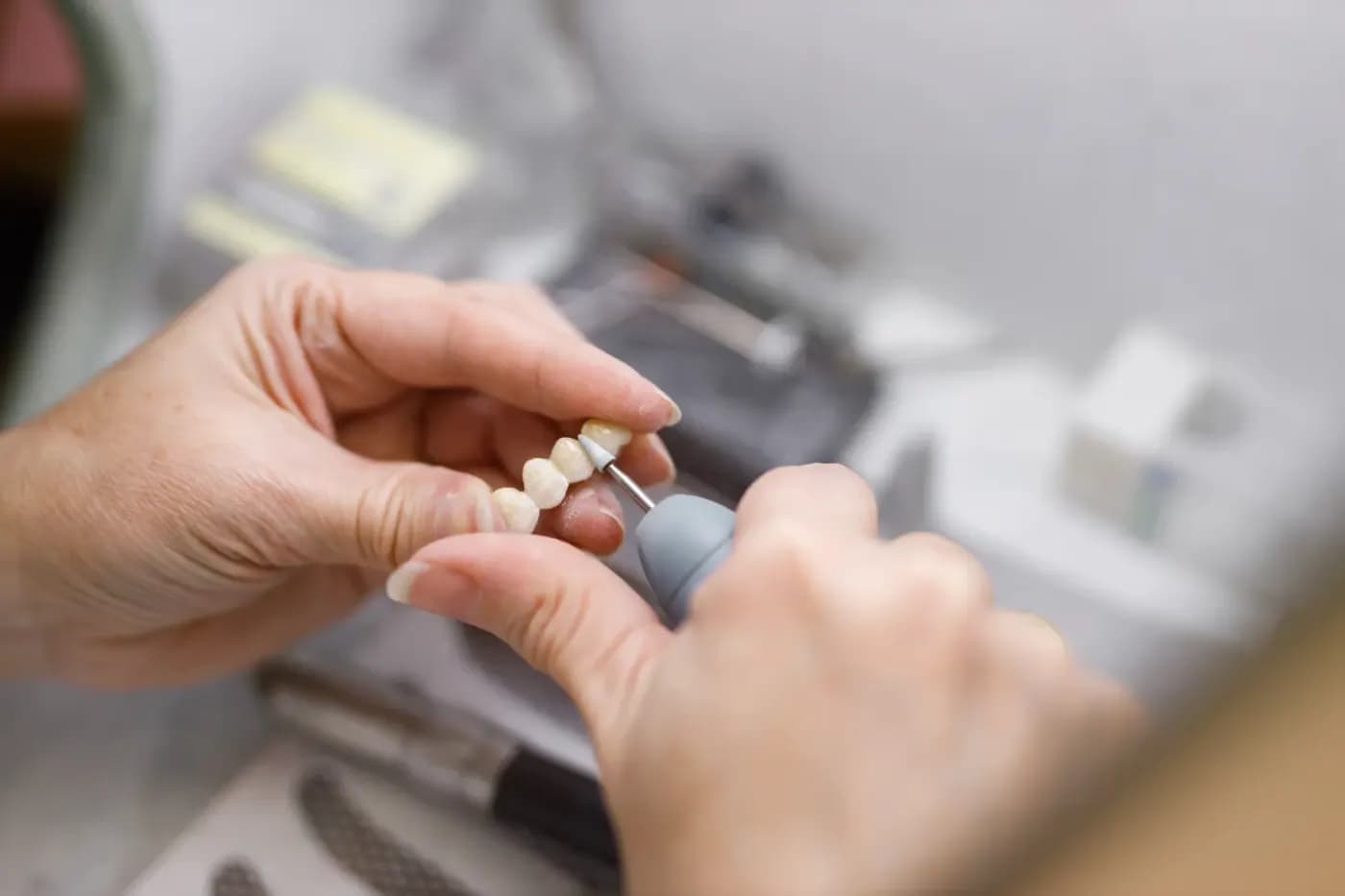 Cirkonio dantų karūnos klinikinis vertinimas ir tinkamumo analizė